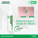 Oxecure 2% Salicylic Acid Body Acne Spray 50ml
