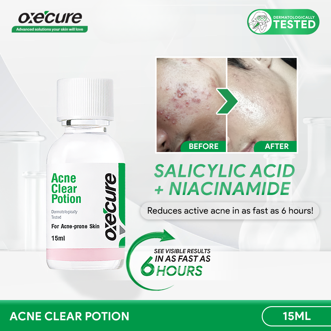 Oxecure 2% Salicylic Acid Acne Clear Potion 15ml