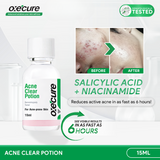 Oxecure 2% Salicylic Acid Acne Clear Potion 15ml