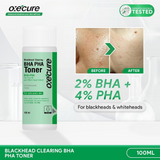 Oxecure Blackhead Clearing BHA PHA Toner 100ml