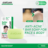Oxecure Sulfur Soap 100g