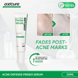 Acne Defense Prebio Serum 20ml