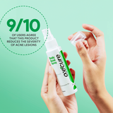 Oxecure 2% Salicylic Acid Body Acne Spray 50ml