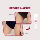 Organic Skin Japan Bikini Whitening Cream 30ml