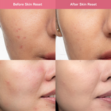 BLK Skin Brightening & Soothing Skin Reset