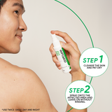 Oxecure 2% Salicylic Acid Body Acne Spray 50ml