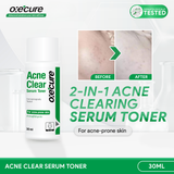 Oxecure Acne Clear Serum Toner