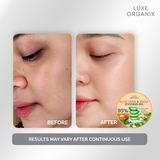 Luxe Organix Aloe Vera & Snail Soothing Gel 95% 300ml