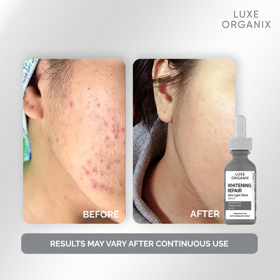 Luxe Organix Whitening Repair Serum Niacinamide 10% 30ml