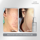 Luxe Organix Whitening Repair Whip Moisturizer 80ml