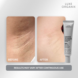 Luxe Organix Intensive Whitening Underarm Cream 10% Niacinamide 40g
