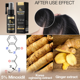 Kormesic Professional 5% Minoxidil Scalp Serum