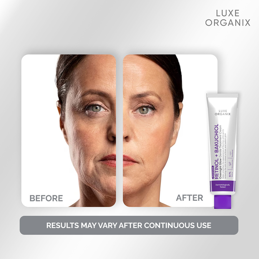 Luxe Organix Retinol + Bakuchiol Overnight Glow Gentle Treatment Cream 30g