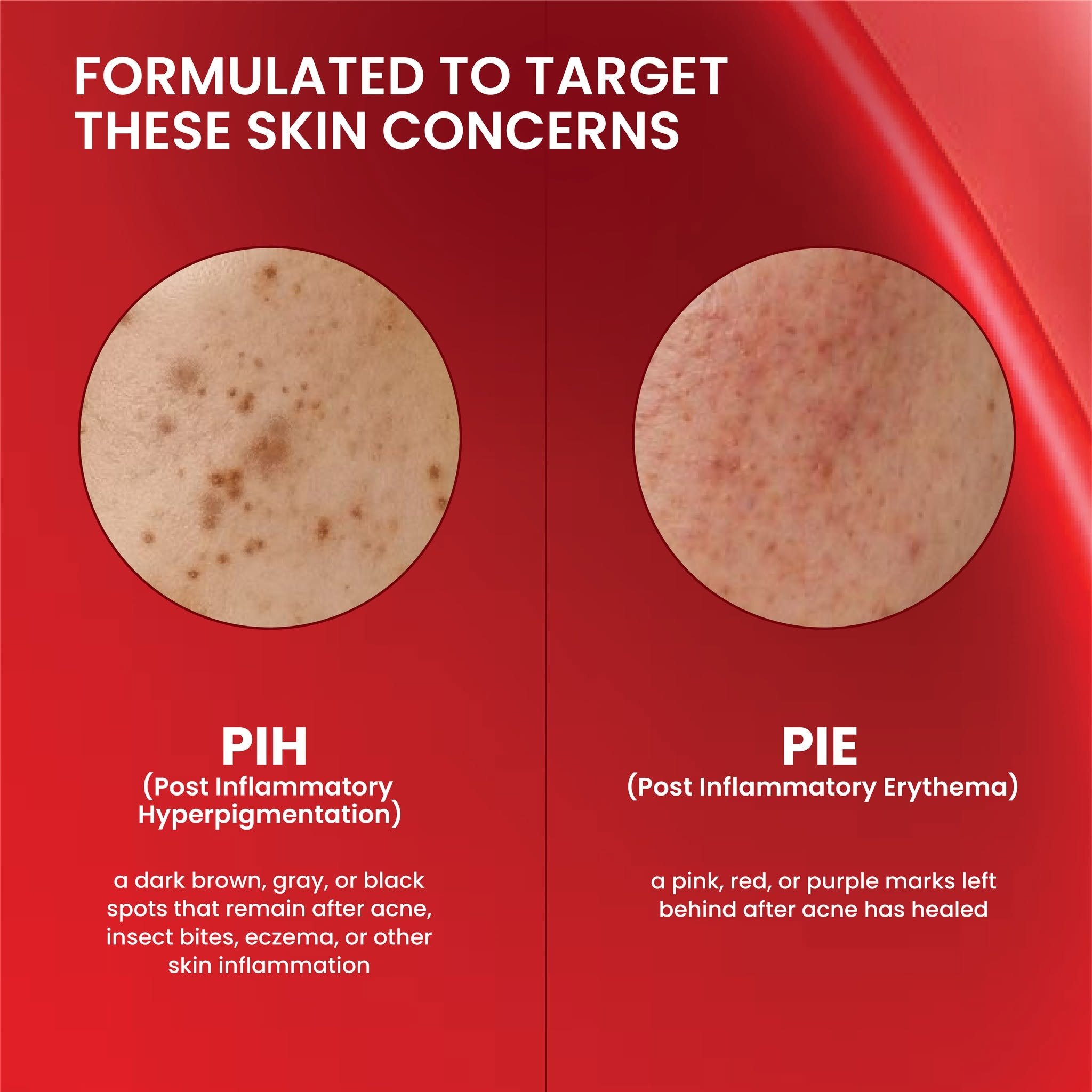 Luxe Organix DermaPRO Complexion Perfecting Renewing Glow Peel Deep Resurface Serum