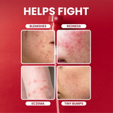 Luxe Organix DermaPRO Hypochlorous Acid 0.02% Clear Skin Defense Antibacterial Mist